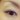 DisView