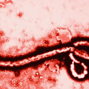 El sorprendente caso de la enfermedad rara que te inmuniza ante el virus del Ébola