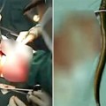Chino es operado de urgencia tras introducirse una anguila viva por el culo para curar su estreñimiento