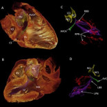 Revelan la fuente de los latidos del corazón humano en 3D (ING) Revelan la fuente de los latidos del corazón humano en 3D (ING)