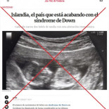 Mitos islandeses: en Islandia no están acabando con el síndrome de Down Mitos islandeses: en Islandia no están acabando con el síndrome de Down