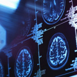 Un estudio detecta por primera vez cambios cerebrales en personas sanas con riesgo de sufrir Alzhéimer Un estudio detecta por primera vez cambios cerebrales en personas sanas con riesgo de sufrir Alzhéimer