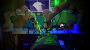 Un robot cirujano experimental puede operar sin ayuda humana