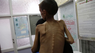 La guerra en Yemen ha causado más de 10.200 niños fallecidos o heridos