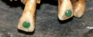 La práctica de los antiguos mayas de pegar piedras preciosas en los dientes puede haber sido más que ostentosa (ENG)