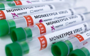 EE.UU. libera dosis de la vacuna Jynneos para tratar la viruela del mono