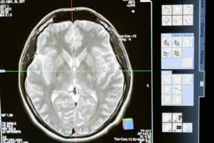 Así es el cerebro de los 'superancianos': neuronas más grandes y memoria superior a personas de 50 años